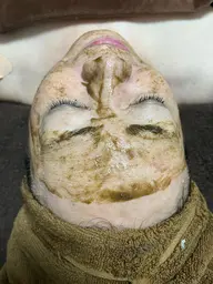 《肌のざらつき・毛穴が気になる方へ》ハーブピーリング＋デコルテマッサージ付