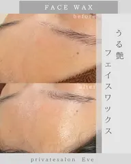 【フェイスワックス】うぶ毛ケア×美肌ケア✨
