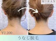 ☆男女OK☆うなじ脱毛☆シェービング、保湿付き☆￥2200