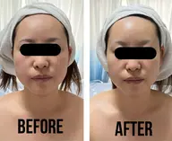 【小顔矯正リフトUP】見た目年齢−10歳も夢じゃない✨リフトアップ&小顔歪み矯正ニュートラルフェイシャル💆♀️70分