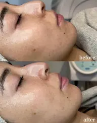 《韓国で大人気!》LHALALAララピール