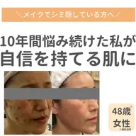 諦めていたシミ、任せてください！！【シミケア】集中美白・トーンアップコース（60分）
