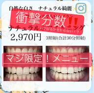 ⭐️【限定5名!】合計40分 ⭐️❤️20分✖️2照射📣しっかり効果!全体的に綺麗に!照射分数が長いからこその白さを!