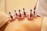 背面カッピング＋大発汗ヒートマット浴¥13,500→¥8,800