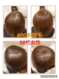 増毛エクステ400本