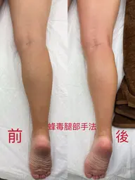 蜂毒ケアオイル　背中循環・ボディライン調整50分