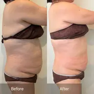 初回最強痩身レモン🍋10cc