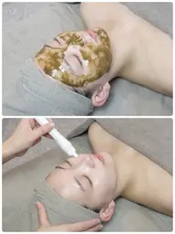 【凹凸毛穴/ザラツキ/ニキビ🫧】肌質改善ハーブピーリング🌿×ハイドロフェイシャル✨艶肌ピーリング付❣️