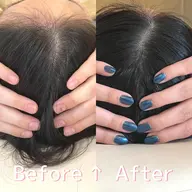 【コロナ禍応援！ミニモ限定価格】ひのえ式ヘッドリフトマッサージ90分✨💆‍♀️