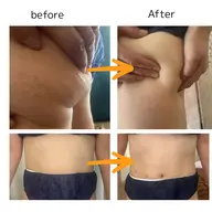 セルゼロ　ボディ　モニター　２月モニター１名様募集