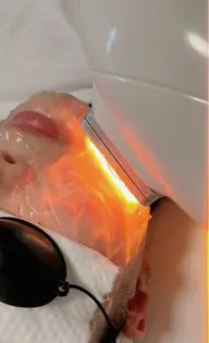 夏向け美肌脱毛コース(顔)