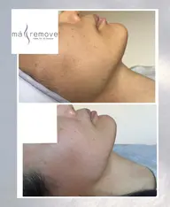 💆マリムーブ フェイシャルワックス　🫧回数を重ねる毎に美肌に近づきます🕊️化粧崩れや繰り返す肌荒れを改善したい方