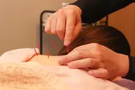 初回割✨ 鍼調整🪡 頭痛や肩こり、腰痛などの不調に!自律神経調整にも🙆♂️