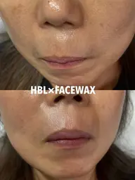 Sパーツワックス(おでこ、頬、鼻毛、口周り)この中から１箇所のみ