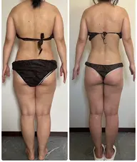 《ボディ痩身》ハイパーナイフ×セルライトを潰し流す!シェイプを組み合わせた痩身エステ🏹✨