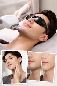 ✨メンズヒゲ脱毛(ほほ、鼻下、あご、あご下)清潔感UP