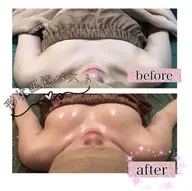 大人気メニュー✨【形状記憶バストケア】✨💖