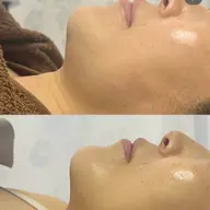 ⭐️4/12.19.20.25限定⭐️ 【Lemon-Bottle美容液導入】気になる脂肪へアプローチ！