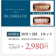 ❤期間限定特別セール❤限定10名様✨【40分照射】高濃度セルフホワイトニング6500円→2980円‼効果実感の声多数◎