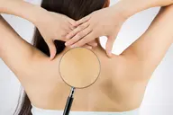 背中ニキビ＋背中脱毛＋シミ 集中ケア　【背中ニキビがある方必見】￥8800