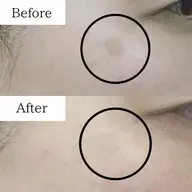 【シミしわ改善・予防ケア】お試し2回※男女OK