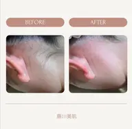 👱🏻♀️うなじワックス👱🏻♀️