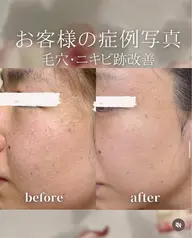 【冬の乾燥・くすみ対策】フェイシャル＋高品質！美白スペシャルケアコース🪽シミ・くすみ改善◎