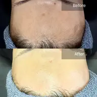 【OPEN記念】卒業できるフェイスワックス🕊️