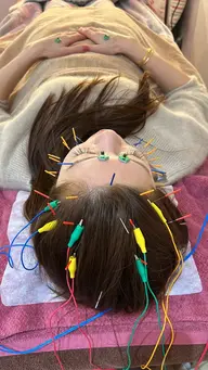 しっかり小顔スッキリコース🧡※美容鍼が初めての方にもオススメです^ ^