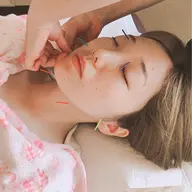 美容鍼120分 (リフトアップ、しわたるみ、ほうれい線、美白効果)フェイス+ボディ調整、更なる効果維持のための総合ケア