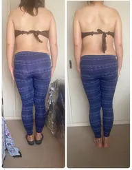 筋膜リリース進化版MRM(Mリリース)