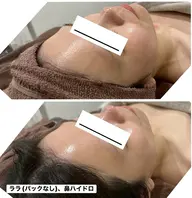 【韓国式美肌】大人気ララ💗写真okモニター