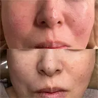 VOSサロンケア♢全世代のお悩みにVOSサロントリートメント♦︎ブラックとホワイト