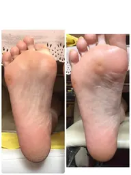 ★新規様★ドイツ式フットケア