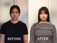 【当店独自矯正】むくまない小顔に！小顔矯正＋リンパフェイシャル￥3980円! !