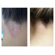 【敏感肌対応♪】肌質改善小顔リフトコース🫧 敏感肌やアトピー肌の方に対応しながら優しくリフトアップ💆🏼‍♀️✨️