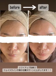 小顔フェイシャル&デコルテトリートメント60分(快眠ドライヘッド込み)