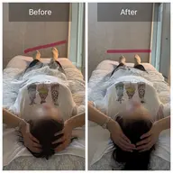 頭蓋骨調整・脳セラピー✖️骨盤調整