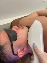 メンズ脱毛🪒ヒゲ✨保湿パック付き😎