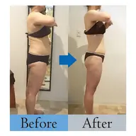 【最新痩身マシン全身打ち放題】一日に打ちる上限ショット数打ち放題