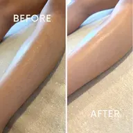 ツルスベ足へ✨両膝下脱毛