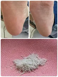 フット　角質除去(ハンドまたはフットとセットの場合)