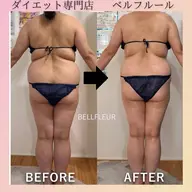 ★平日限定★セルライトゼロ全身✖️リンパ痩身