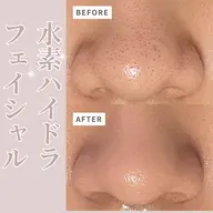 【4月平日ご来店限定‼️】水素水ハイドラフェイシャルフルコース🫧パック付き🫶🏻