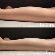 今月限定‼️脚のむくみ・疲れに◎小顔コルギ+頭蓋骨調整&美脚コルギ コース19500円→9500円