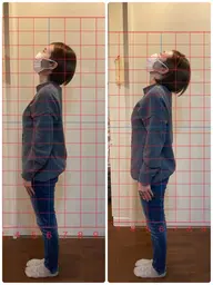 カイロプラクティック体験施術