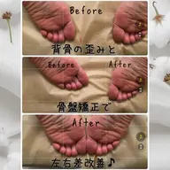 【🧍‍♀️パンパン足腰/腰痛改善に🧍‍♂️】背骨/骨盤矯正＋アロマリンパマッサージ120分