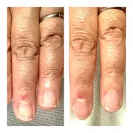 究極のネイルケア