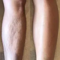 メンズWax脱毛初回★すね毛★