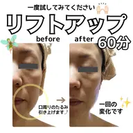 ポレーション込み🌟マシンとハンドの60分で小顔リフトアップシミケアが可能。7980円